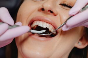 Contrôle orthodontique